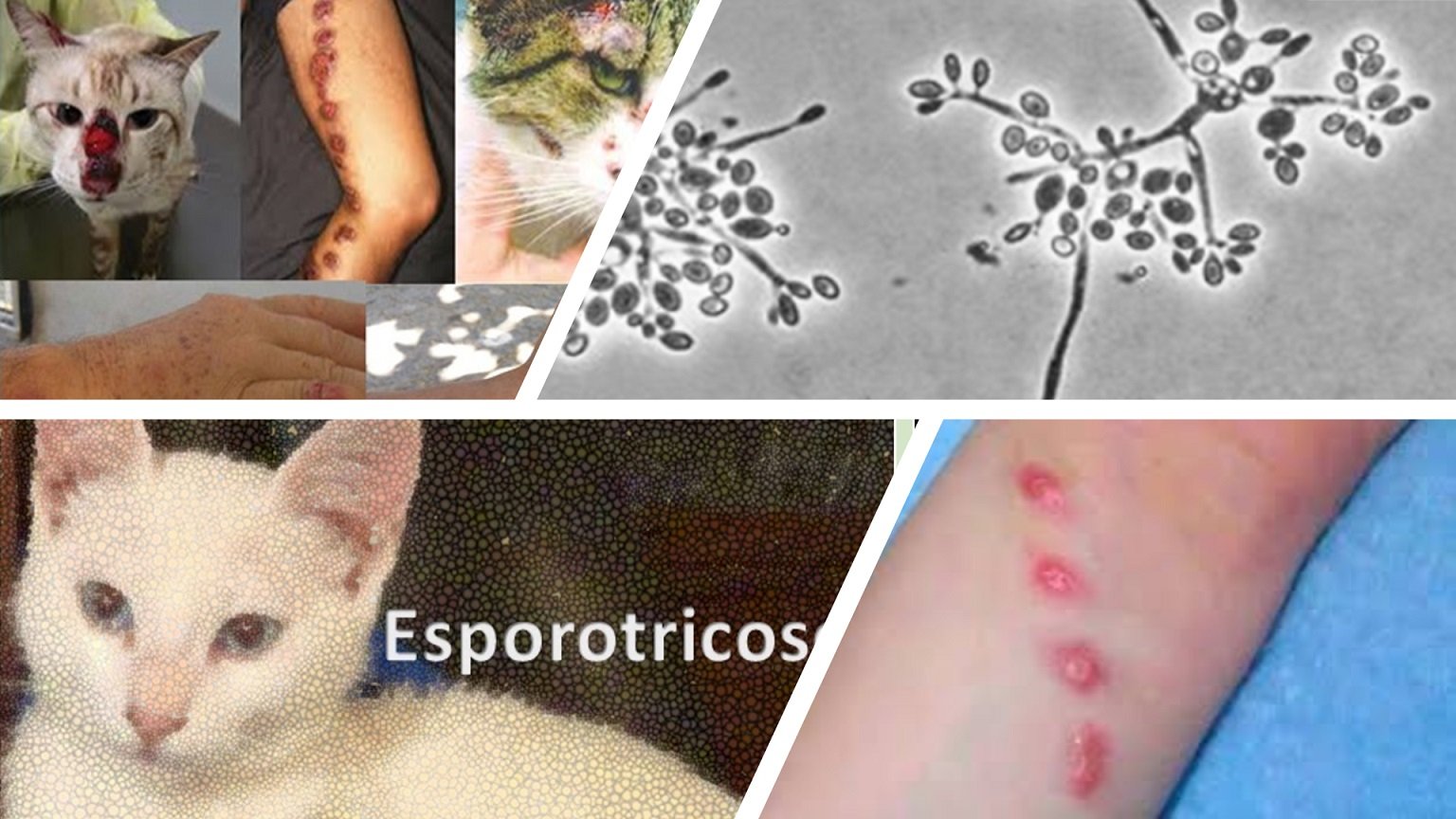 Esporotricose humana: recomendações da Sociedade Brasileira de Dermatologia  para o manejo clínico, diagnóstico e terapêutico