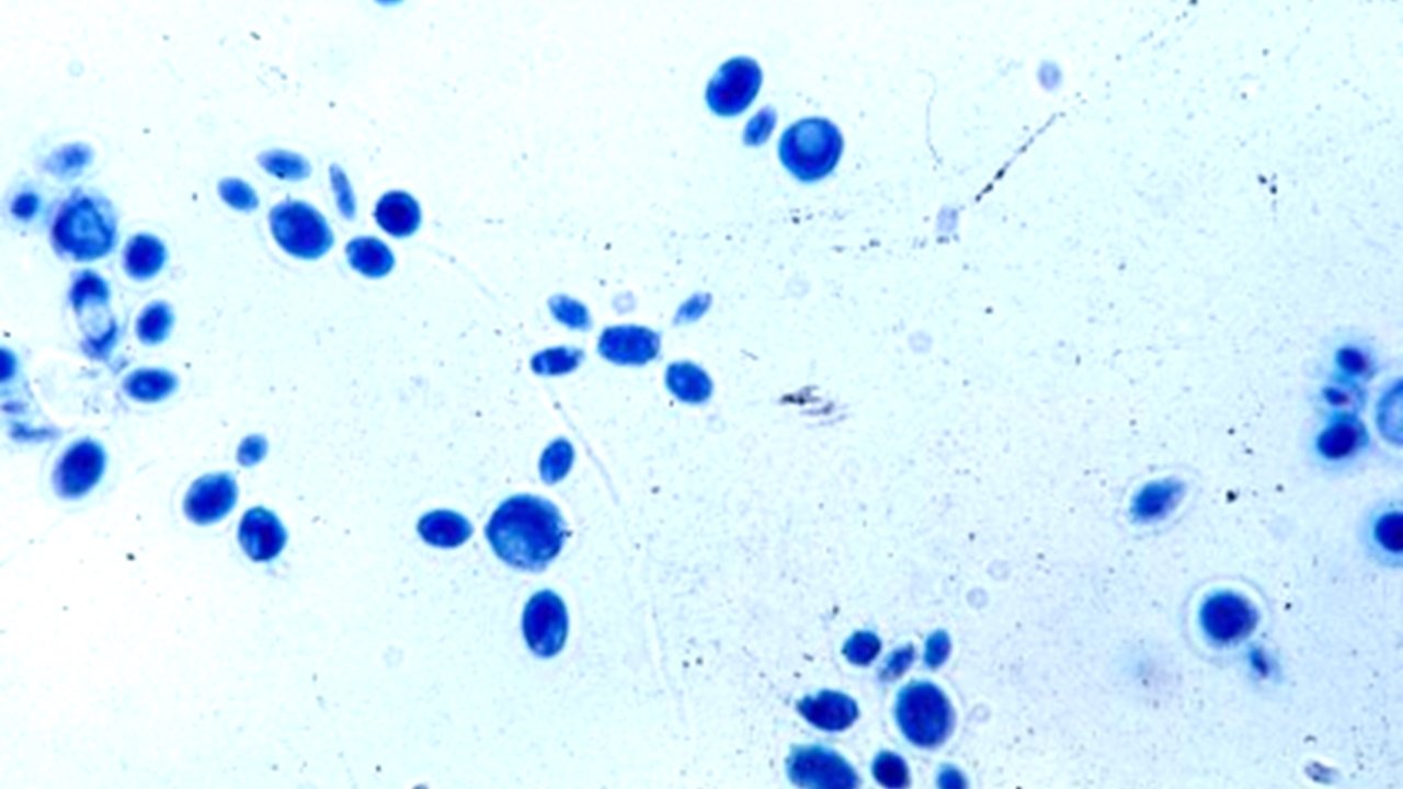 Esporotricose humana: recomendações da Sociedade Brasileira de Dermatologia  para o manejo clínico, diagnóstico e terapêutico